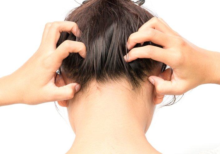 démangeaisons cuir chevelu remède naturel